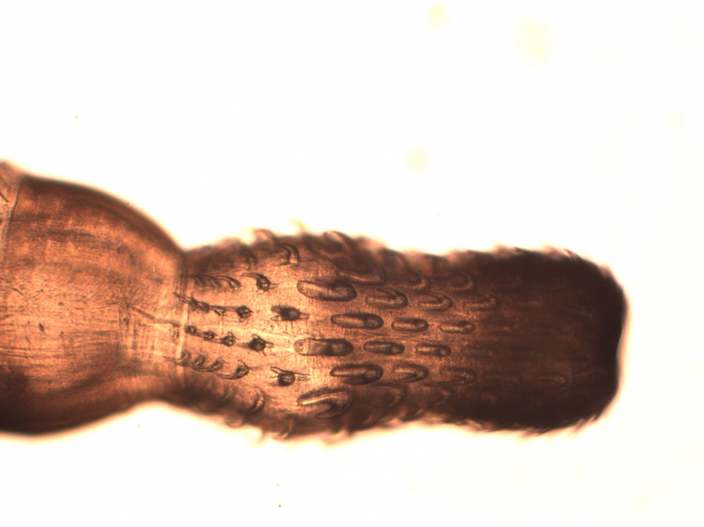 The spiky attachment organ of a larval thorny-headed worm